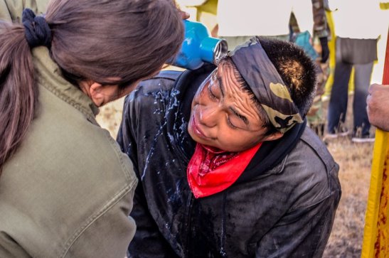 22 Oct 2016. A Water Protector being rinsed off after Police OC sprayed him without provocation 3 miles west of Highway 1806. Photo by Rob Wilson Photography